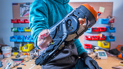 Illustration for article titled These Hackers Built a Prosthetic Nerf Blaster That Can Be Fired by Flexing Arm Muscles